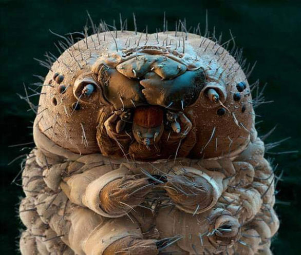 "Chân dung" bọ Demodex sống trên mặt người